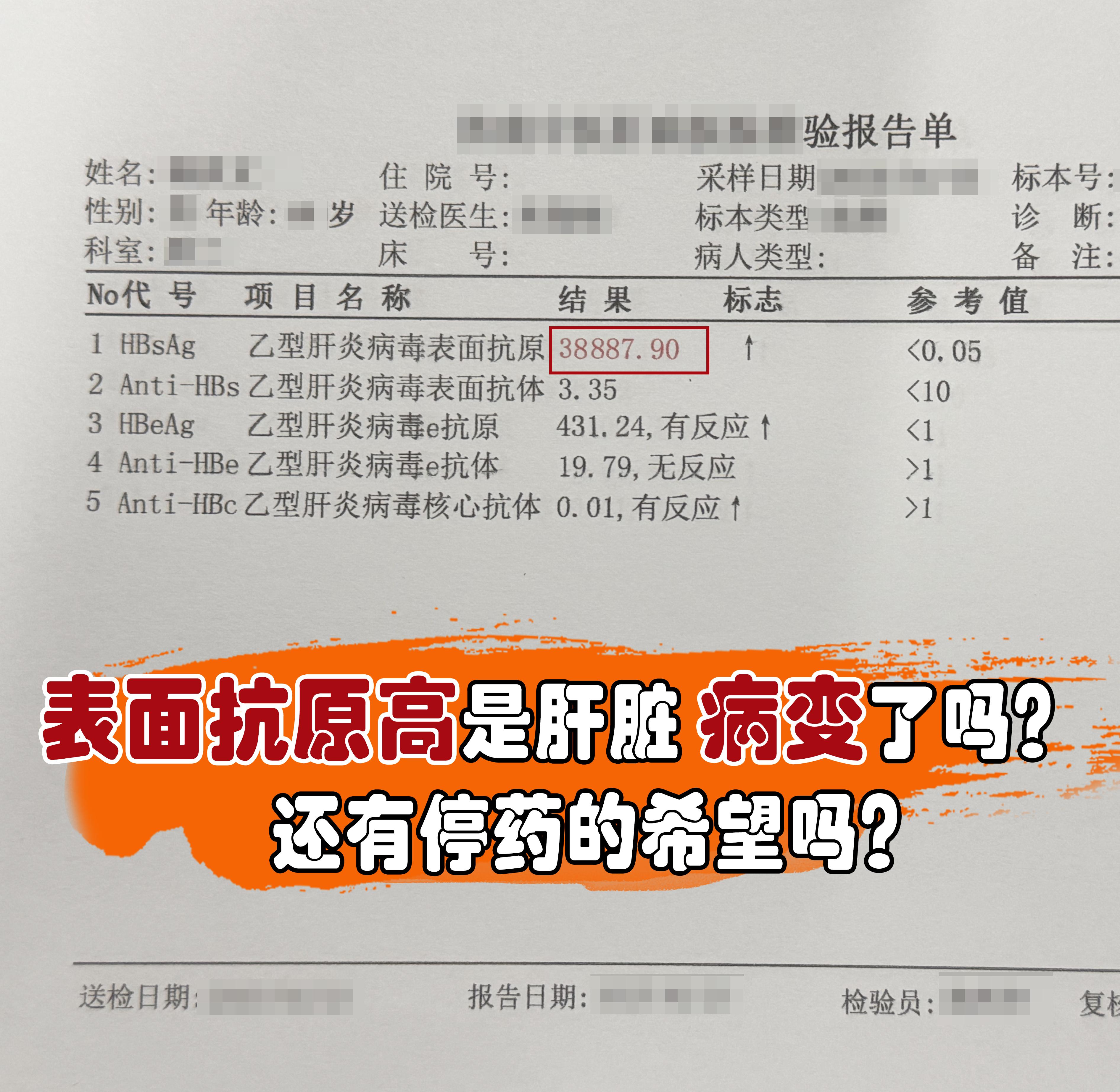 这是一位大三阳的患者，乙肝表面抗原3万多，是肝脏病变了吗？  其实乙肝...