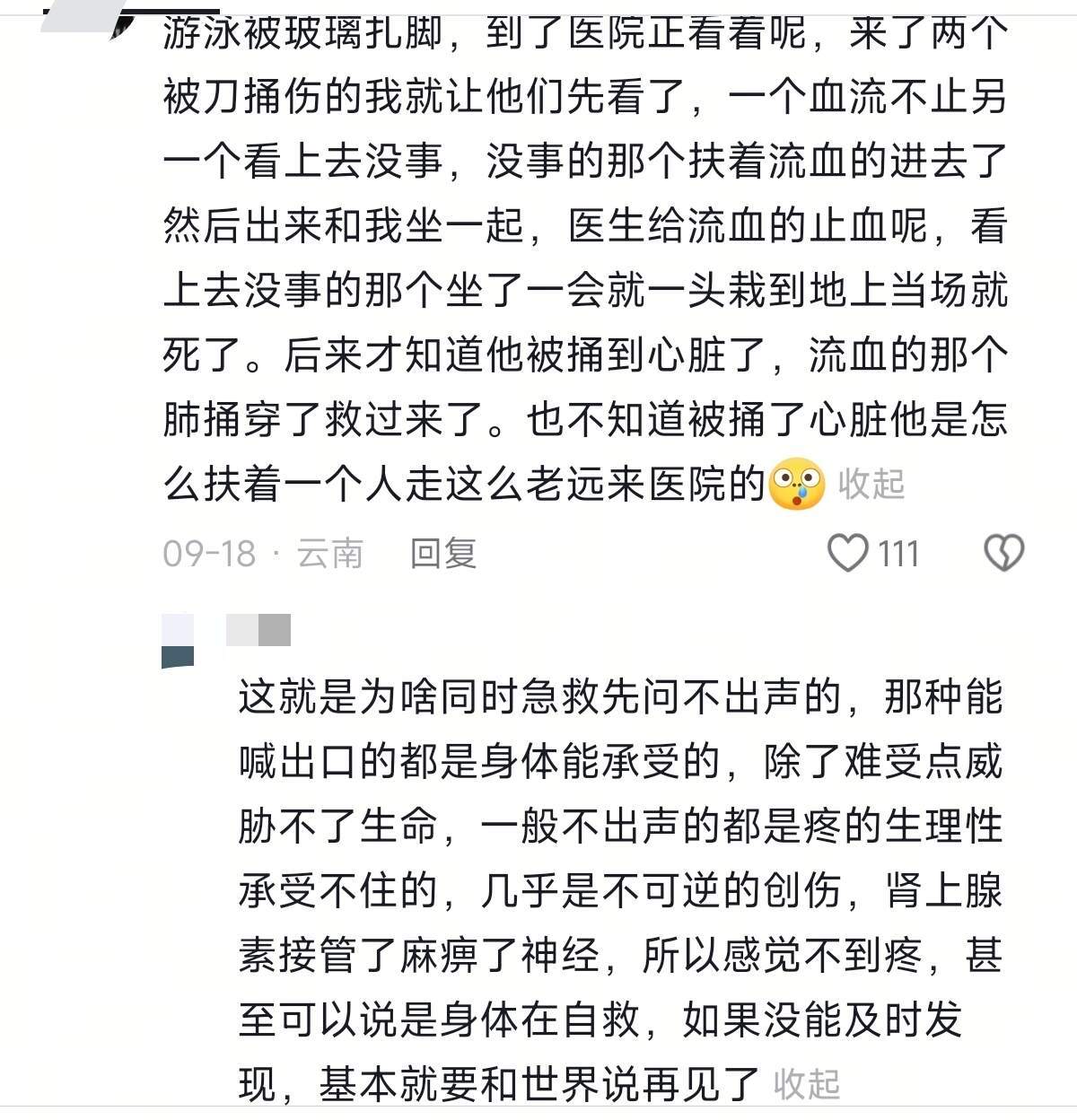 急诊的结石看起来最轻了，虽然看着就很疼​