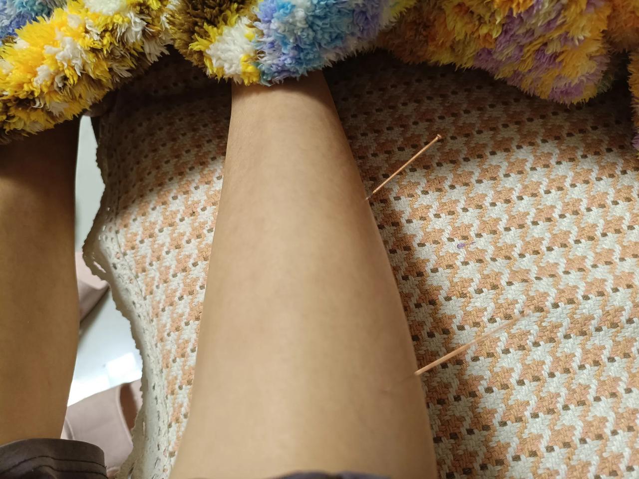 我发现我自己真是个狠人！最近在学习中医，针灸课上老师开始讲穴位，讲功效，讲到
