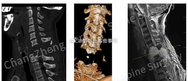 大家在听到哪些病例的时候会有一种医学竟然发展到这种地步的震撼？