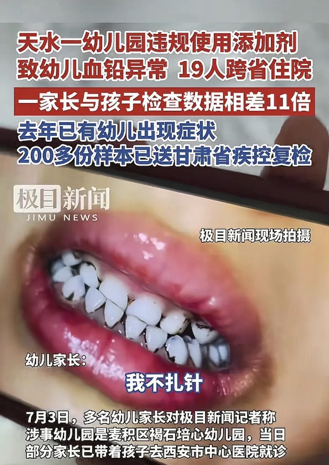 捂不住了，才肯承认！甘肃省天水市麦积区一家幼儿园发生集体铅中毒事件，当地的说法叫