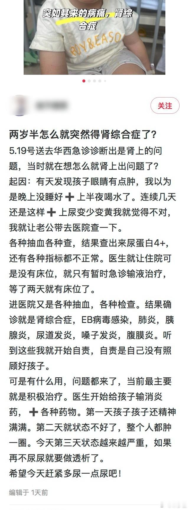 两岁半的孩子，肾综合症。EB病毒，前前后后得过三次新冠。主张病毒感染锻炼免疫力的