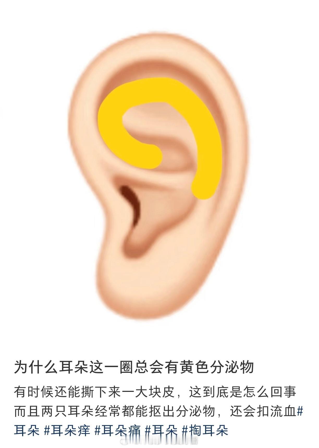 终于有人科普了耳朵这一圈的黄色分泌物​​​