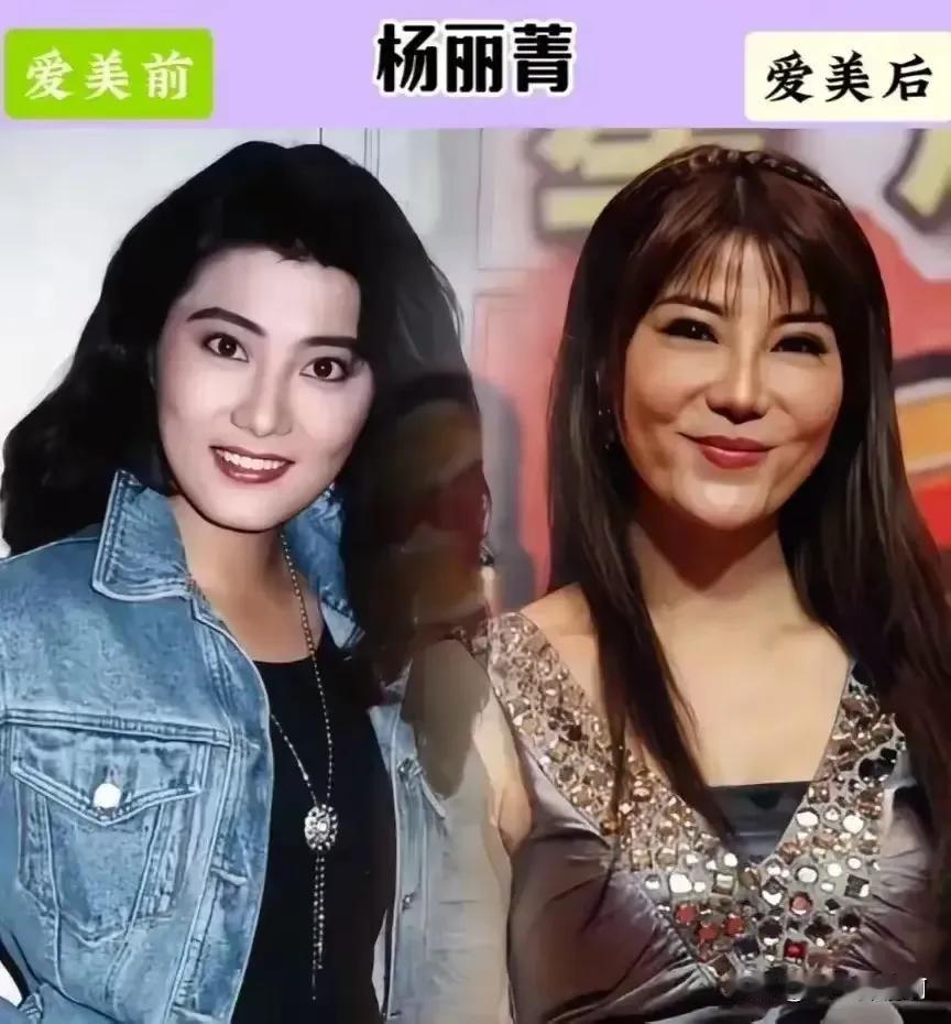 整残了的十位女明星哪一位只可惜