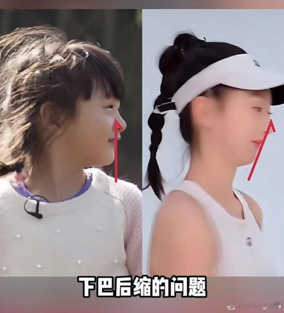 森碟18岁了还是很美的是不是下巴去调整了比之前好很多