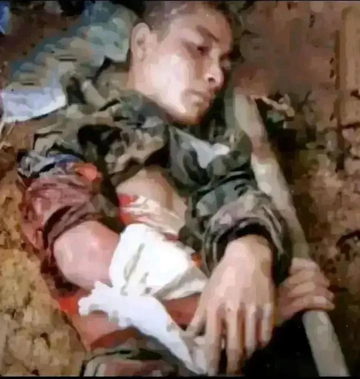 这张照片是老山一等功臣向志平，在他生命弥留之际，留给我们的最后影像，年轻的生命就