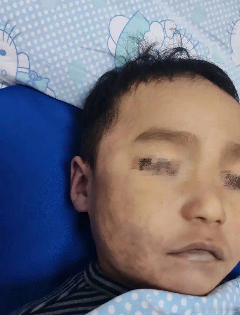 一男童在医院发生医疗事故？男童母亲称：孩子在妇幼医院输完液十多分钟后不舒服，抢救