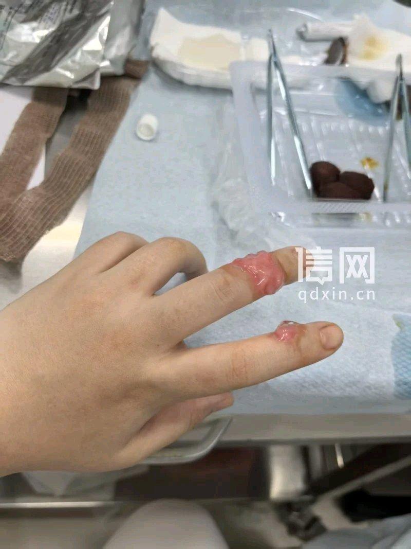 海底捞这事儿真让人无语。浙江谭女士在杭州一家海底捞大排档用餐，端起热汤碗准备喝时