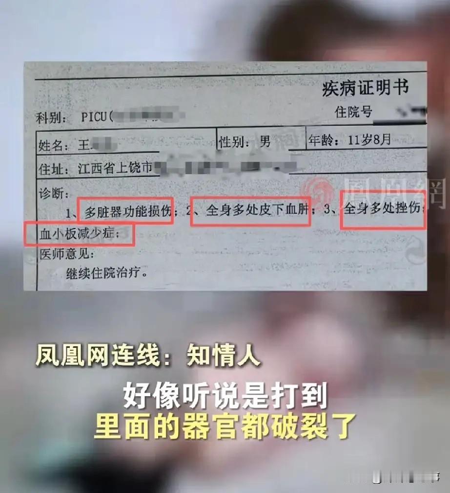 太痛心了!江西上饶那个被欺负的孩子,才11岁零8个月啊!被五六个同学堵着打,硬生