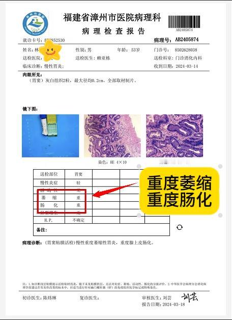 林师傅，53岁，治疗前：重度萎缩性胃炎、重度肠上皮化生。经过半年的中医治疗，萎