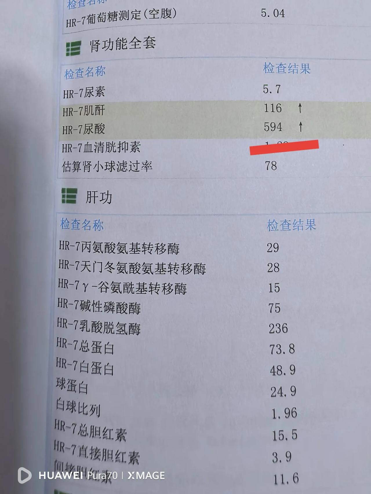 一个月，尿酸从595降到440，我是怎么做到的？我的尿酸很高，