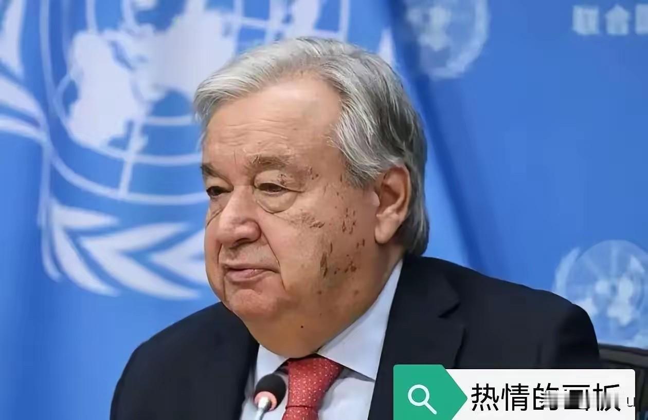 一声惊雷，从联合国总部传来！联合国秘书长古特雷斯向全世界通告：二战爆发是由日本