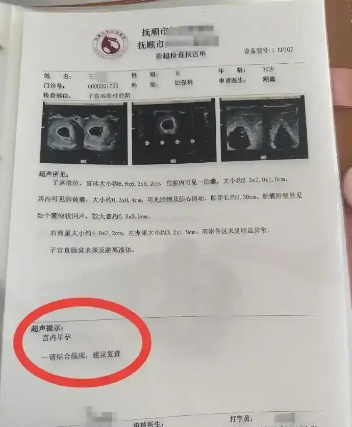 活久见！辽宁抚顺，女子怀孕后去做产检，可令她没想到的是，每做一次产检，彩超单上都