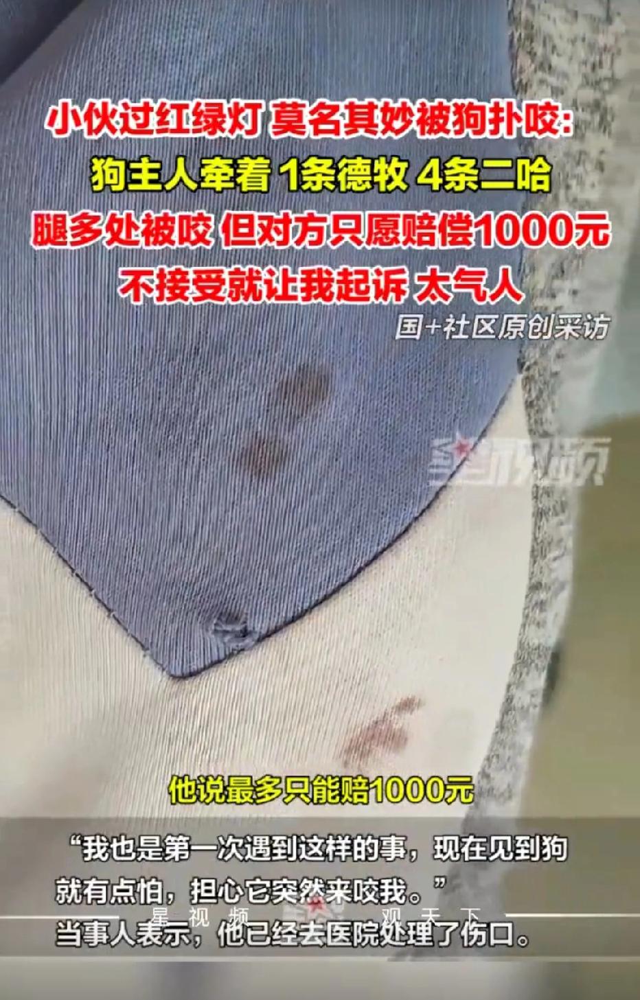 广东深圳，男子过红绿灯，发现一女子牵了5只成年犬，没想到，男子被其中一只德牧咬伤