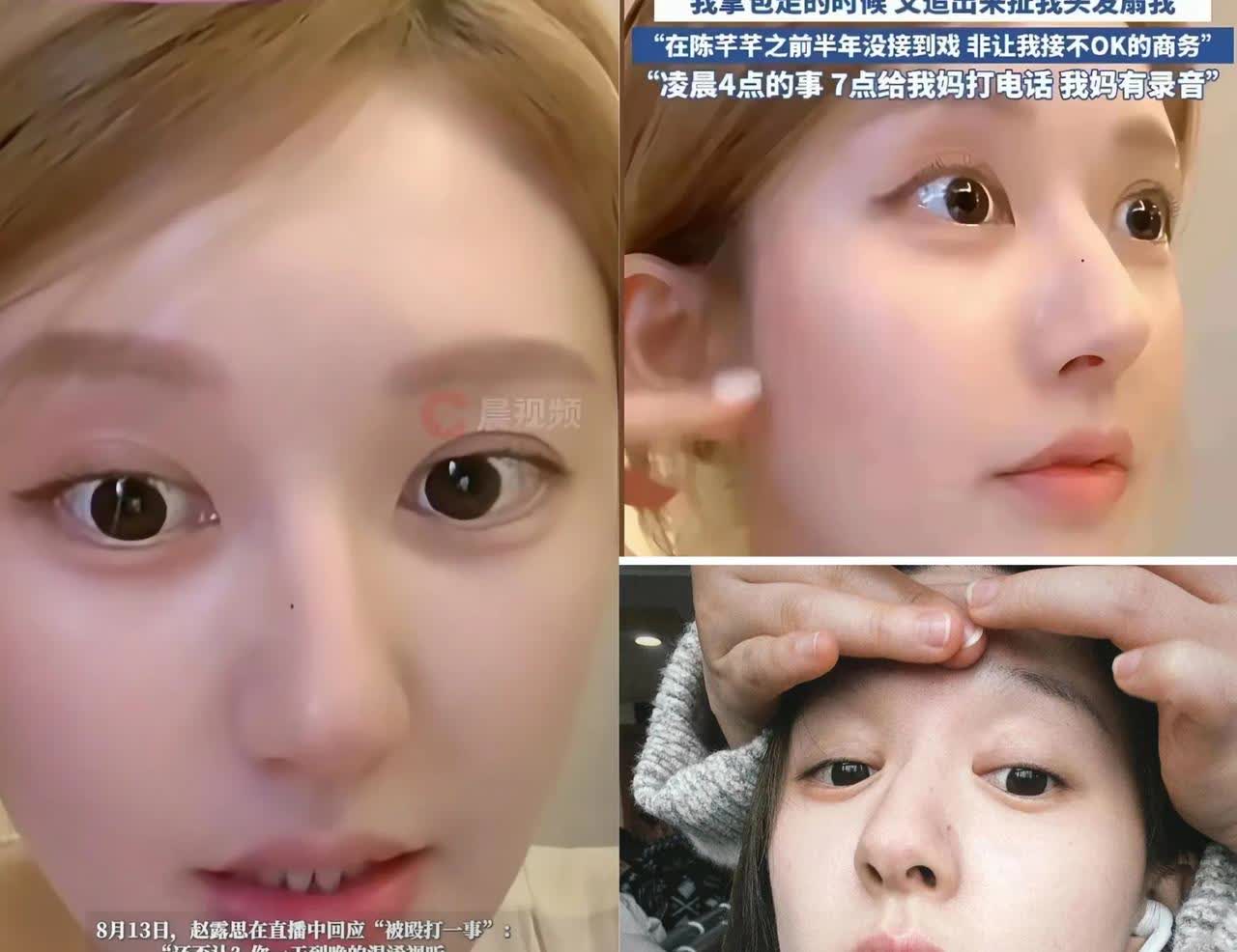终于弄明白了，赵露思为什么敢公开说出被打的过程了，不是因为她真疯了，而是