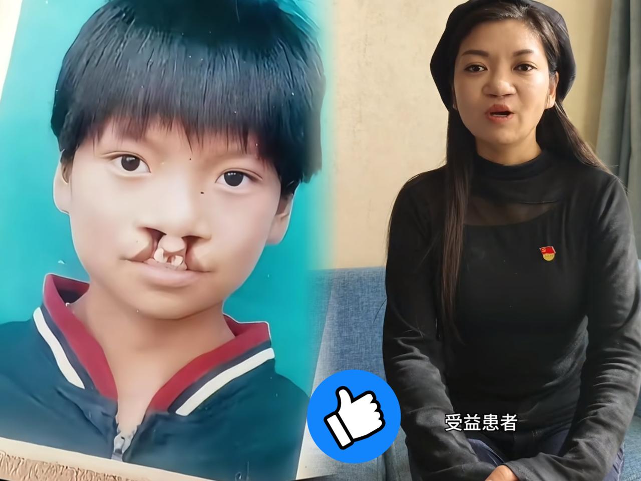 大家有没有想过，为啥7000例免费治疗唇腭裂的患者里，没多少人站出来帮李亚鹏说话