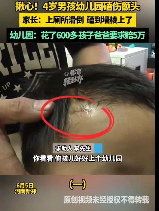 “狮子大开口！”河南郑州，4岁的男童在幼儿园里摔倒，园方把还孩子送到医院，总共花