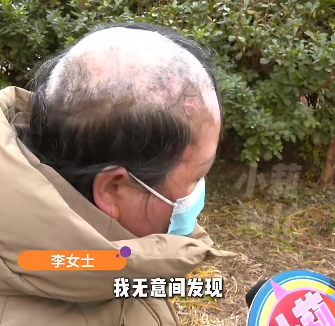 “16年婚姻抵不过容貌变化？”结婚16年河南李女士因白癜风容貌“断崖式衰老”，竟