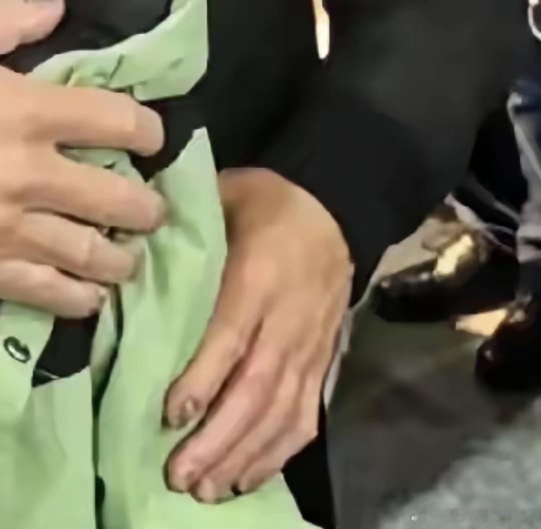 黄仁勋的食指怎么了？明显的黑斑，中指也有，烟熏的？