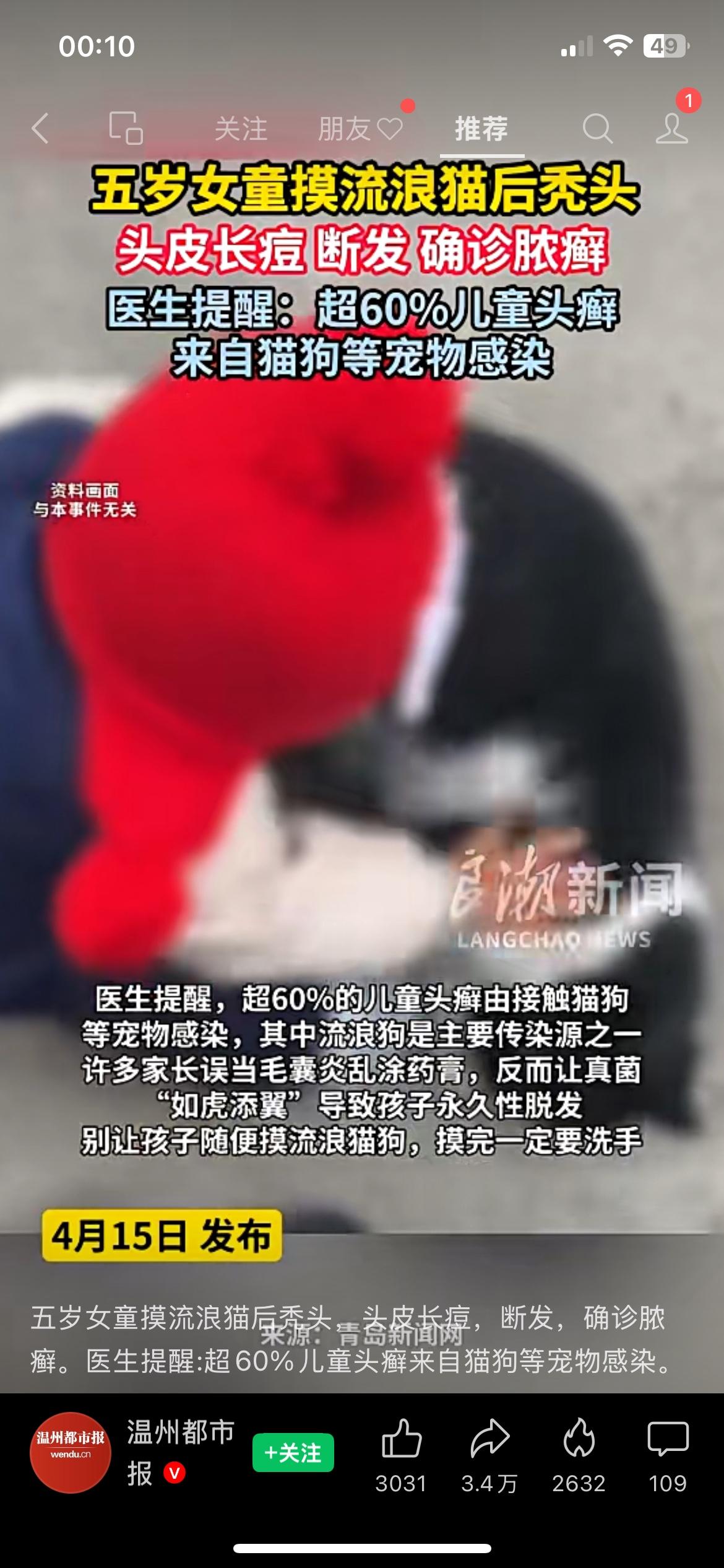 孩子摸完流浪猫狗，没做这件事真可能染上头癣看到一个挺让人心疼的事，一个5岁小女