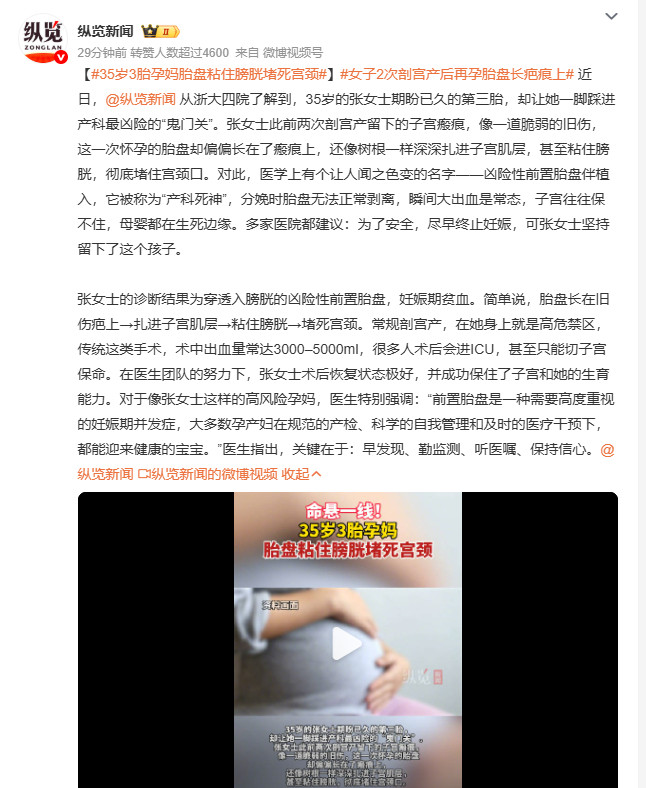 35岁3胎孕妈胎盘粘住膀胱堵死宫颈浙大四院35岁的张女士，三胎之路撞上产科“鬼