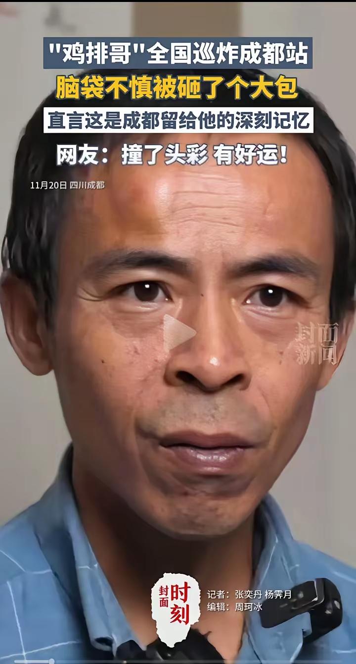 全国巡演你见过，全国巡炸你见过吗？头上撞了个大包！说是成都留给他的深刻记忆。