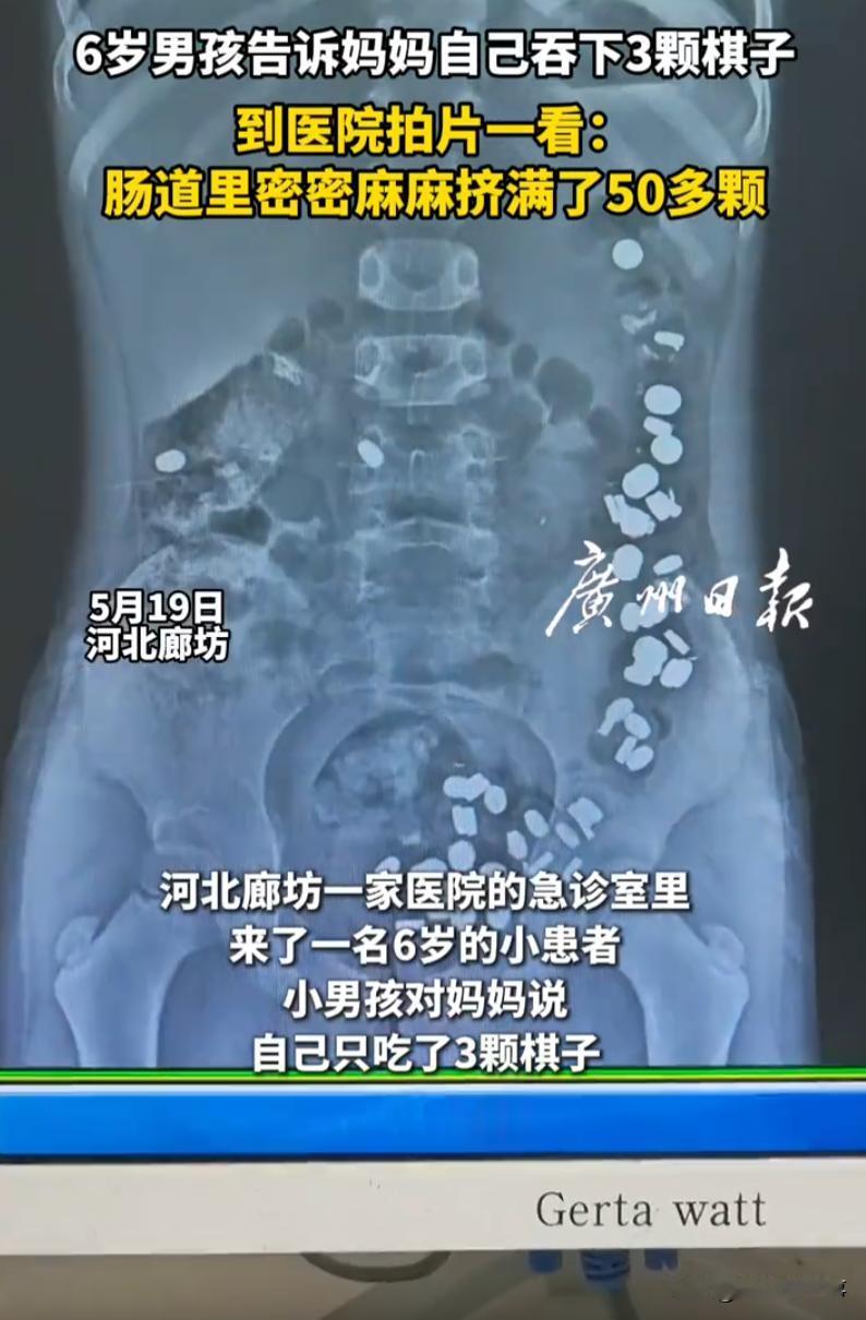 这熊孩子！河北廊坊，妈妈发现6岁的孩子身体不对劲，一问得知吃了三颗棋子，妈妈吓得
