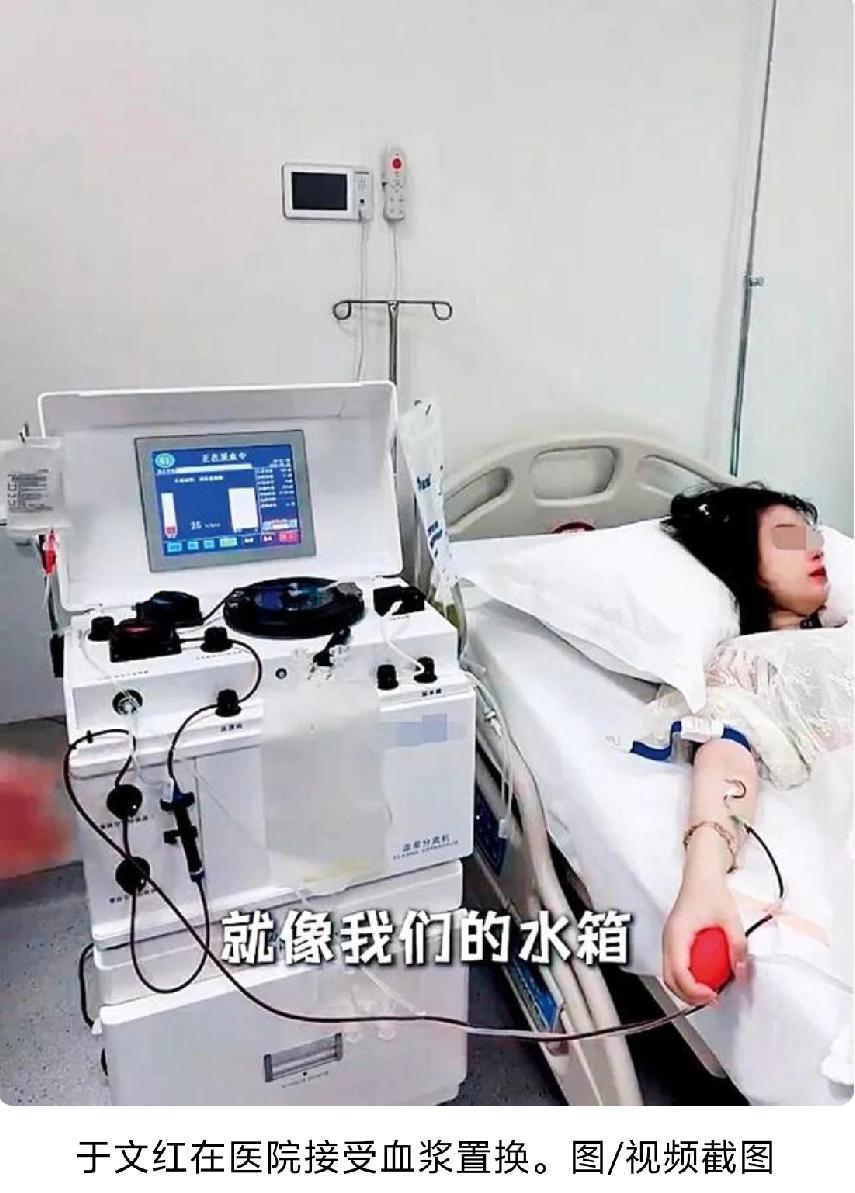 花几百万，置换17岁男孩的血浆？网红，美容店女老板于文红亲口说。而且她自己也置换