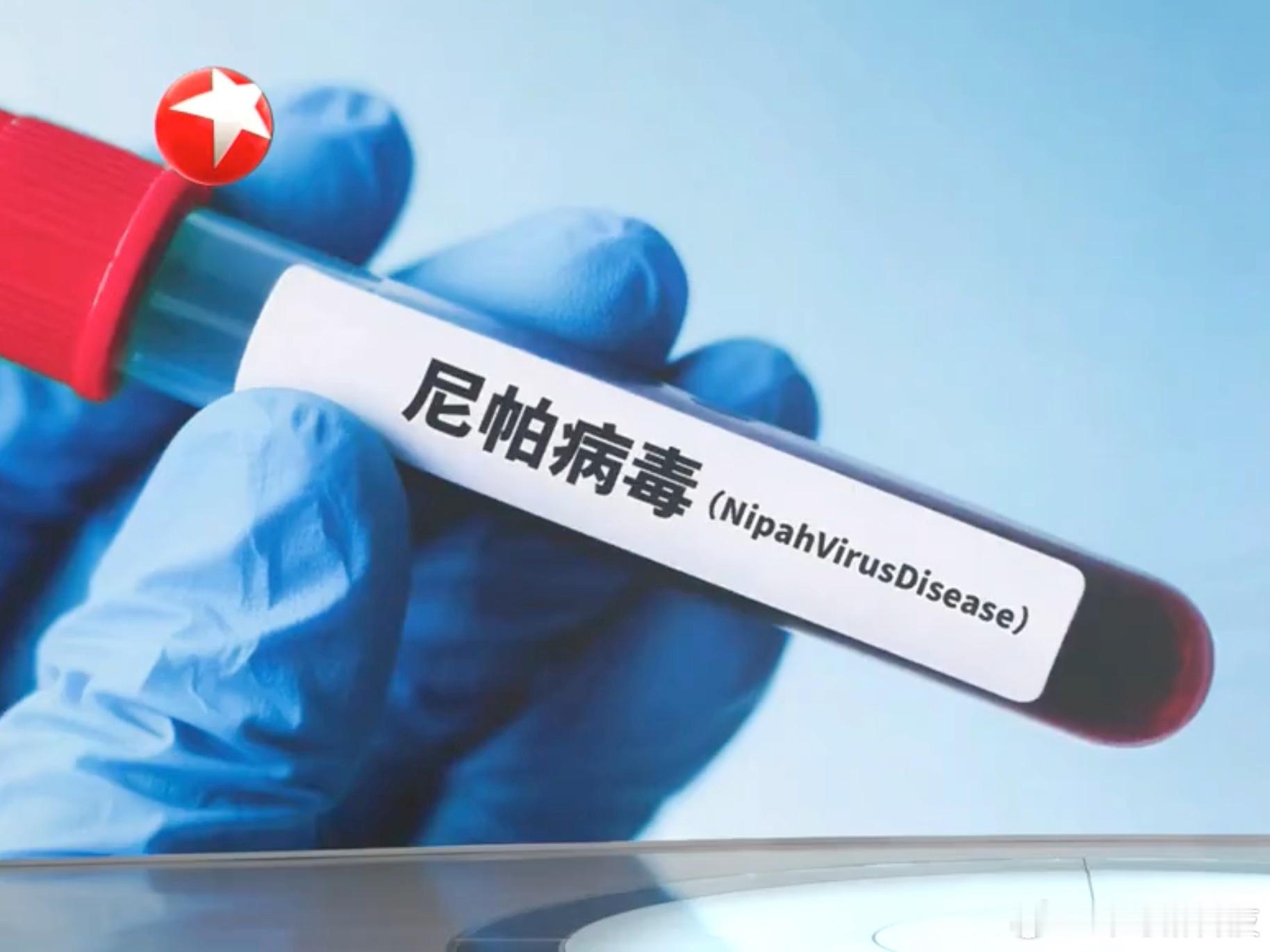 我国已将尼帕病毒纳入检测范围好家伙……这病毒死亡率在40%到75%之间，且没有