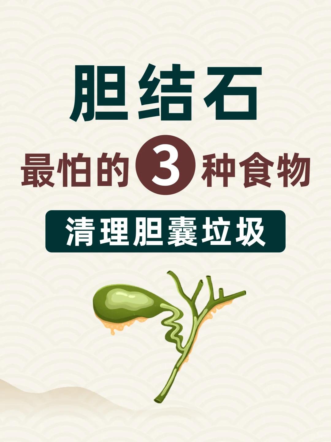 胆结石，最怕的3种食物，清理胆囊垃圾！
