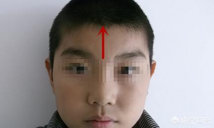 小孩发烧, 有哪些外用退烧方法? 妈妈们看完这4点就不会纠结了