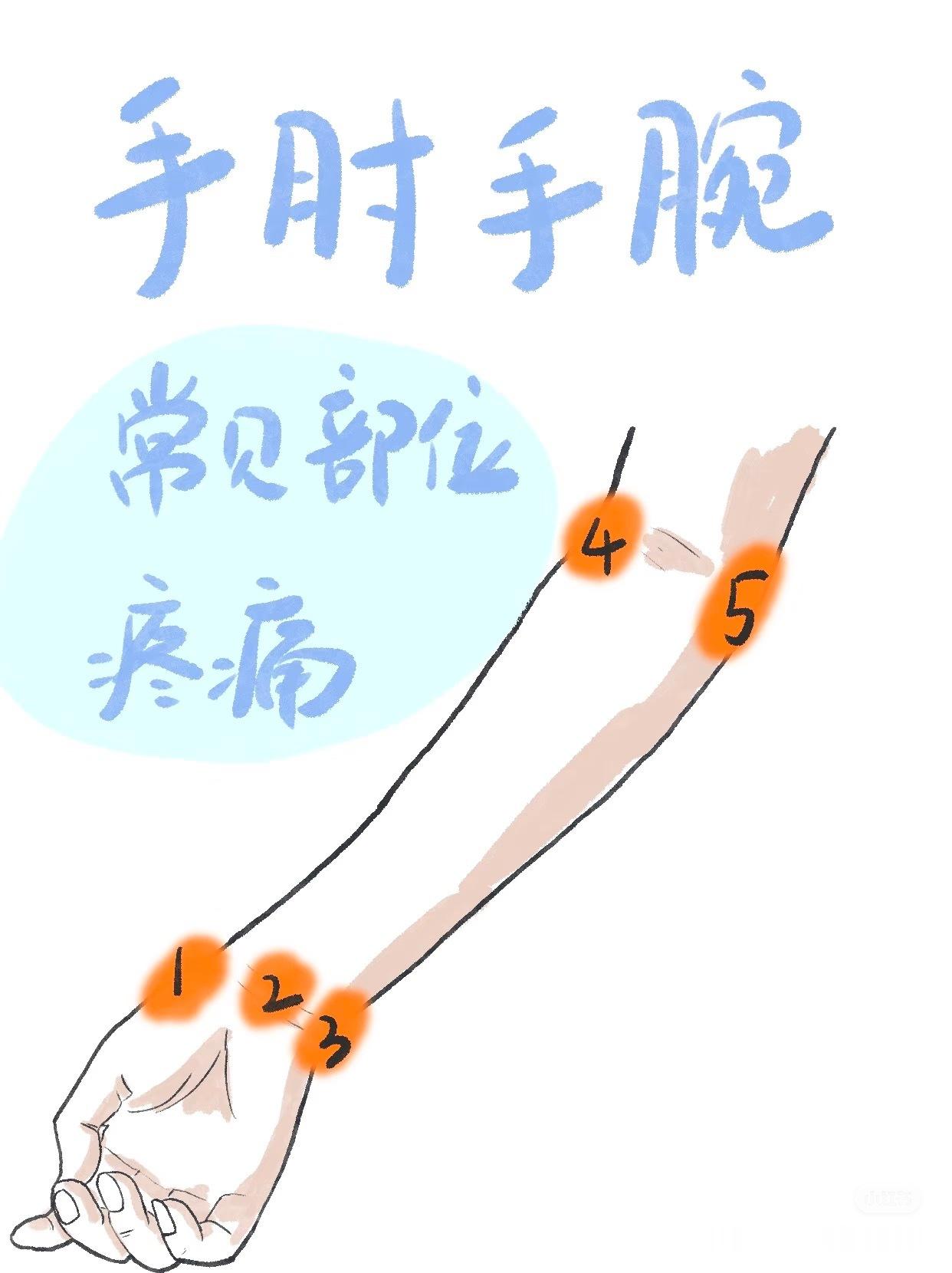 运动康复【手腕损伤盘点】手腕不同的位置，也有不同的损伤原因，来看这份图解盘点[