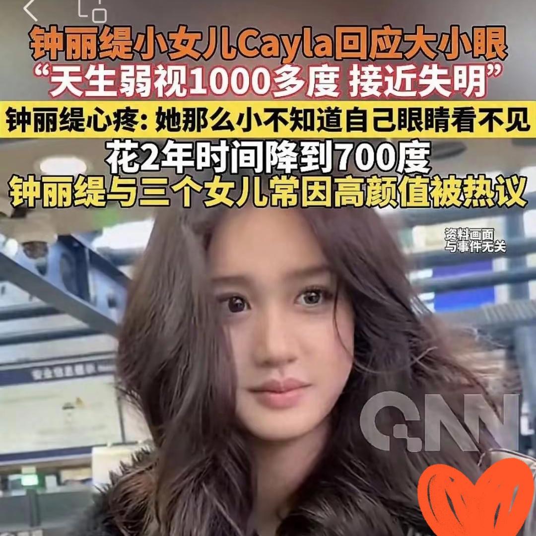 太揪心了！钟丽缇直播曝小女儿天生弱视，1000多度险失明，5岁偶然检查才发现