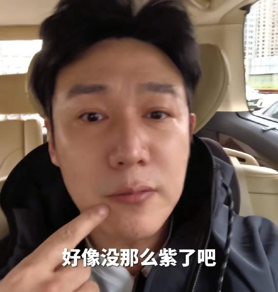 陆毅的体检报告，道出帅哥的“中年危机”！近期陆毅因网友提醒嘴唇发紫，主动去医