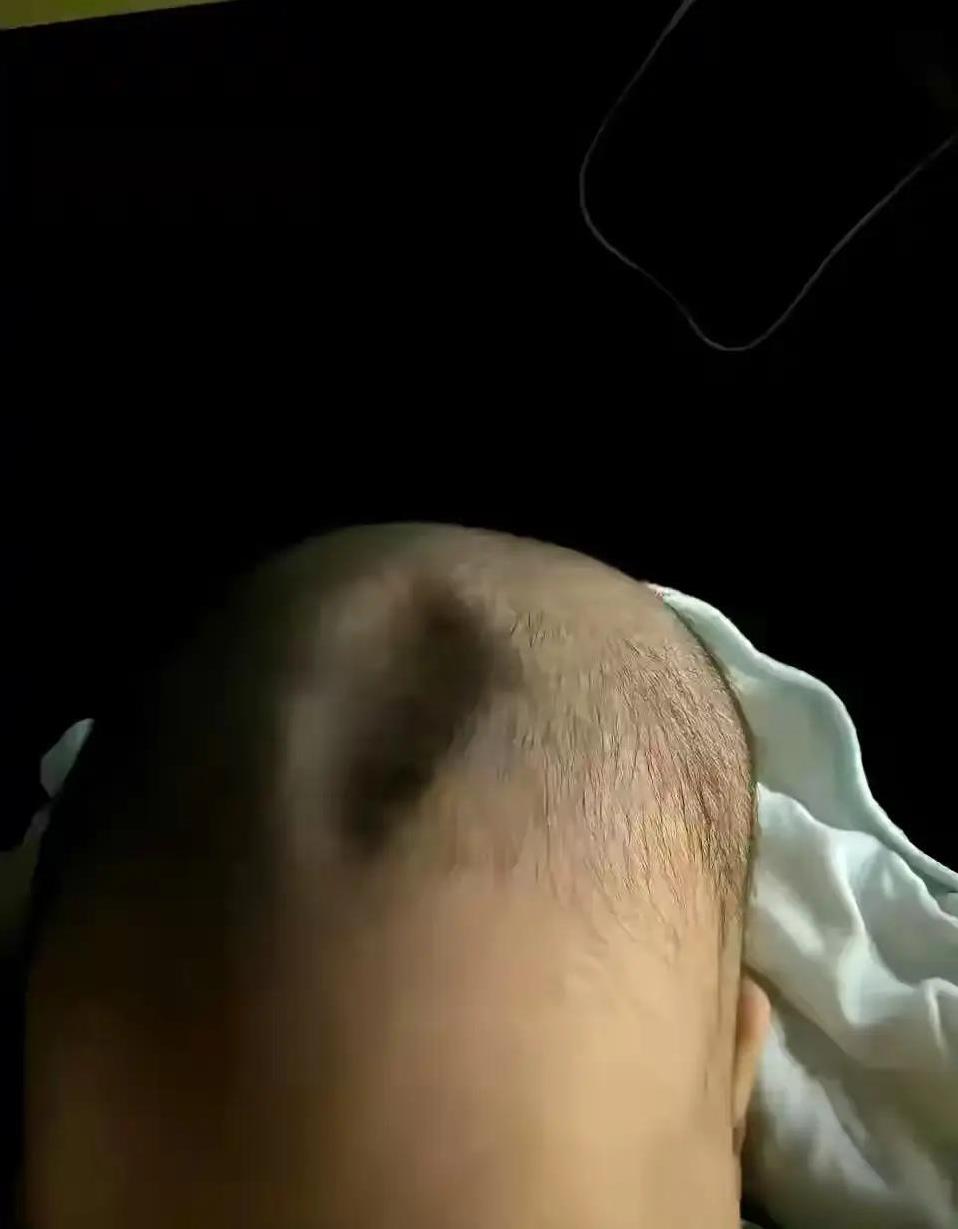 小孩子的头像都是这样子吗？好可怕的，这是正常的吗？