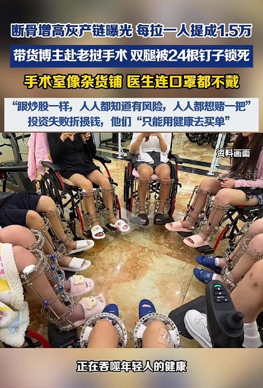 丧尽天良！江苏，一女子身高1米55，一直羡慕高挑的女生。在网上看到“断骨增高”的