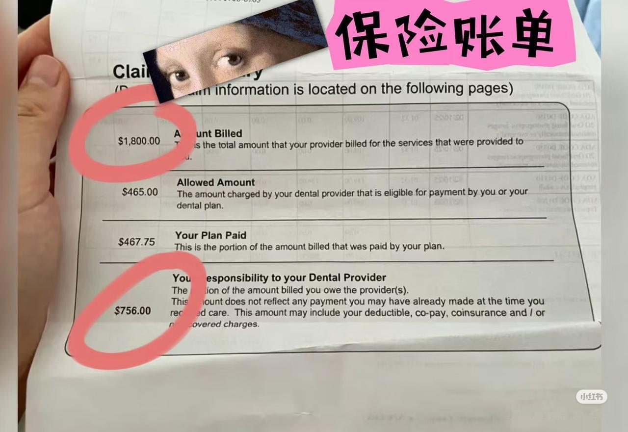 在美国看病真贵呀，补一颗牙理论上花了1800多美元。一个人在美国诊所补牙，