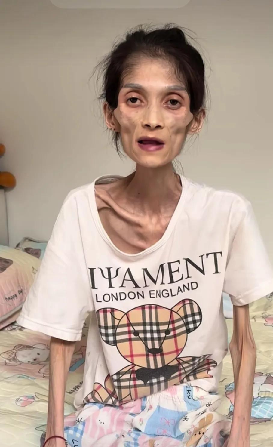 她为什么活成这样，你能相信，她只有二十七岁吗？！我以为是减肥造成的，结果，是不可