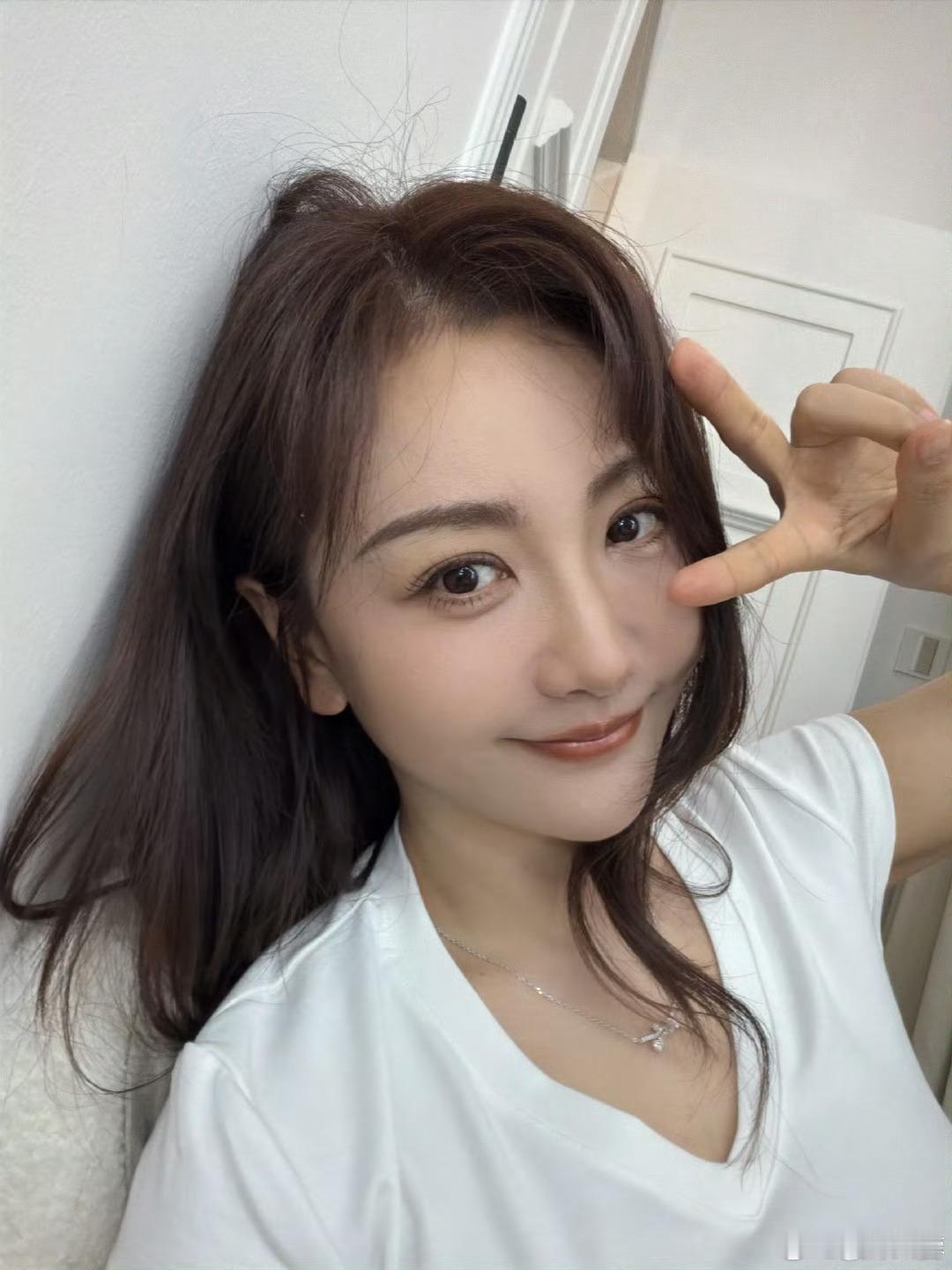 看到杨蓉烫伤恢复后的近照，淡去的疤痕藏着坚韧，姐姐大大方方晒照不遮掩，松弛又自信