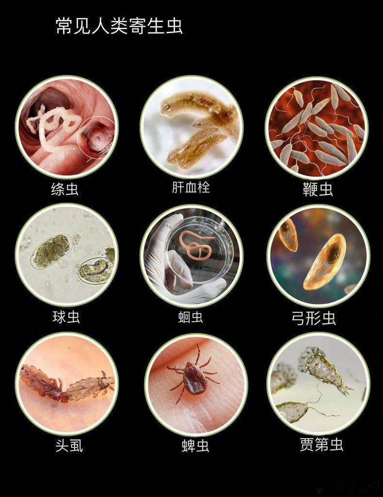 🪱人体寄生虫及其副作用.....🪱绦虫：贫血、维生素B12缺乏症、胰腺炎