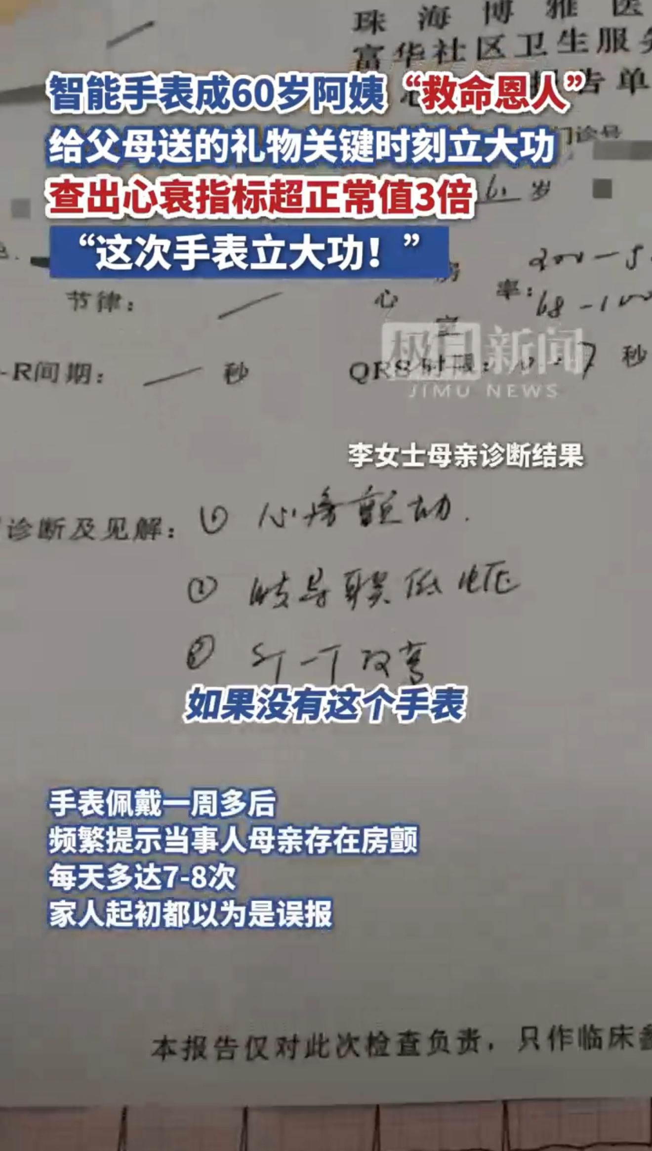 咱就是说，给爸妈选智能手表真不是跟风！原以为就图个看血压方便，结果手表频繁提示异