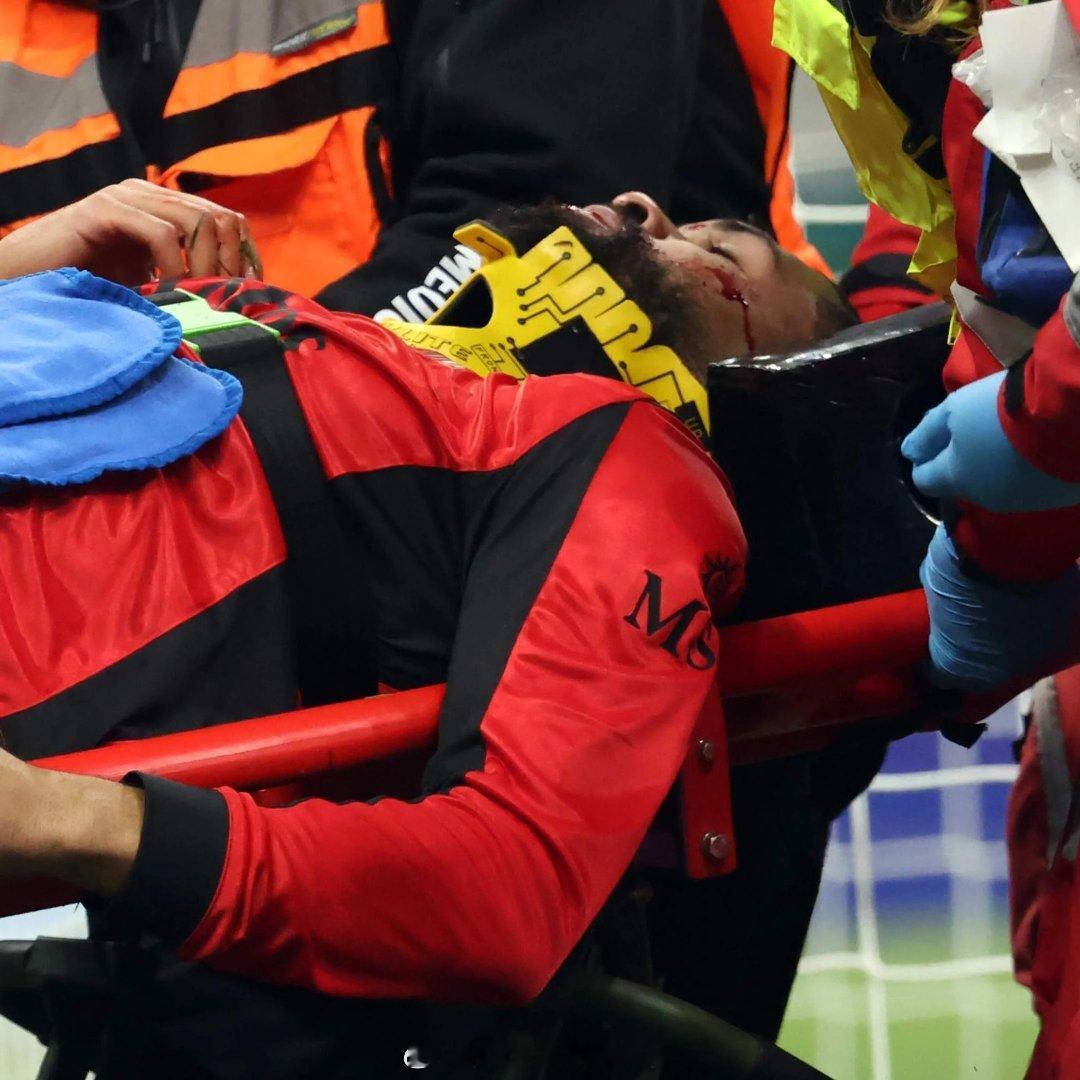 【痛到入骨！慎点图片】30岁英格兰国脚中场，效力AC米兰的洛夫图斯-奇克，在比赛