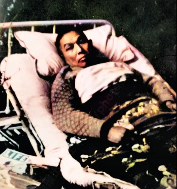 病榻上的杨森，拍摄于1939年，杨森患急性阑尾炎手术后刚刚拆线，即不顾医生劝阻赶