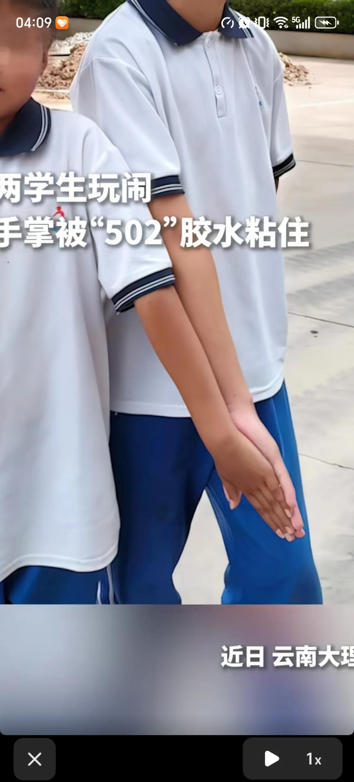 云南大理两个学生用502胶水玩闹，把两人的手粘的密不可分，老师送医解决不了，找了