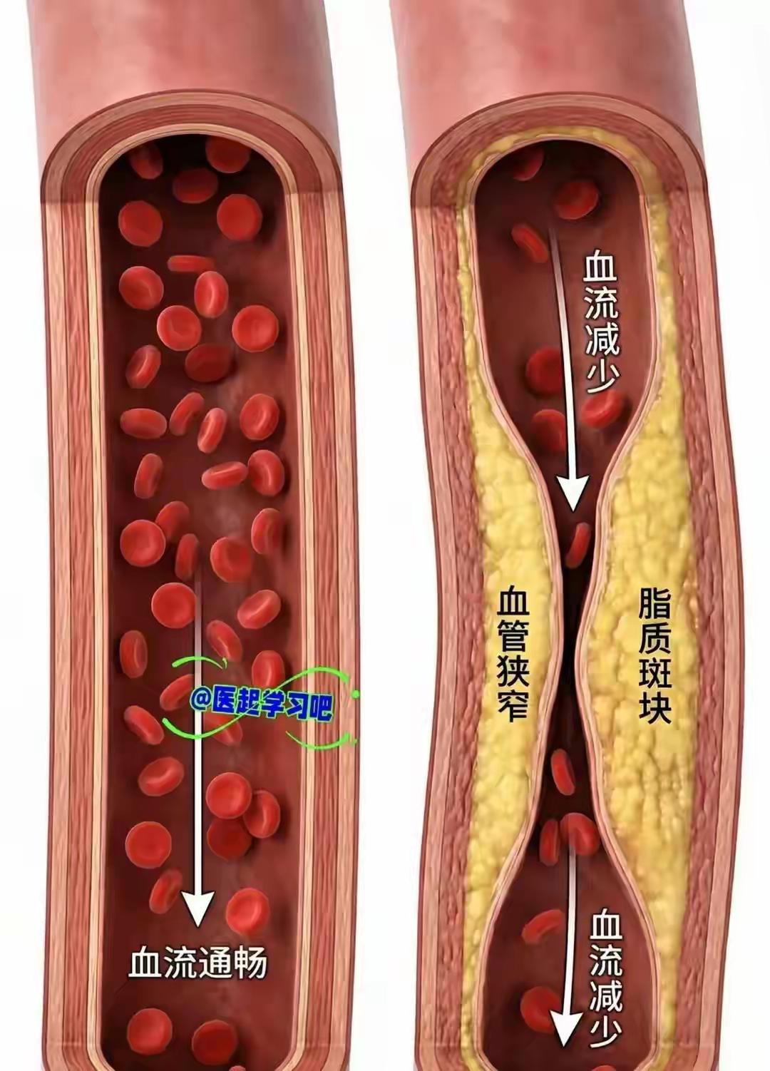 38岁壮汉一周狂练10次猝死！妻子哭诉“劝不听”，全网惊醒：你的自律正在杀死你！