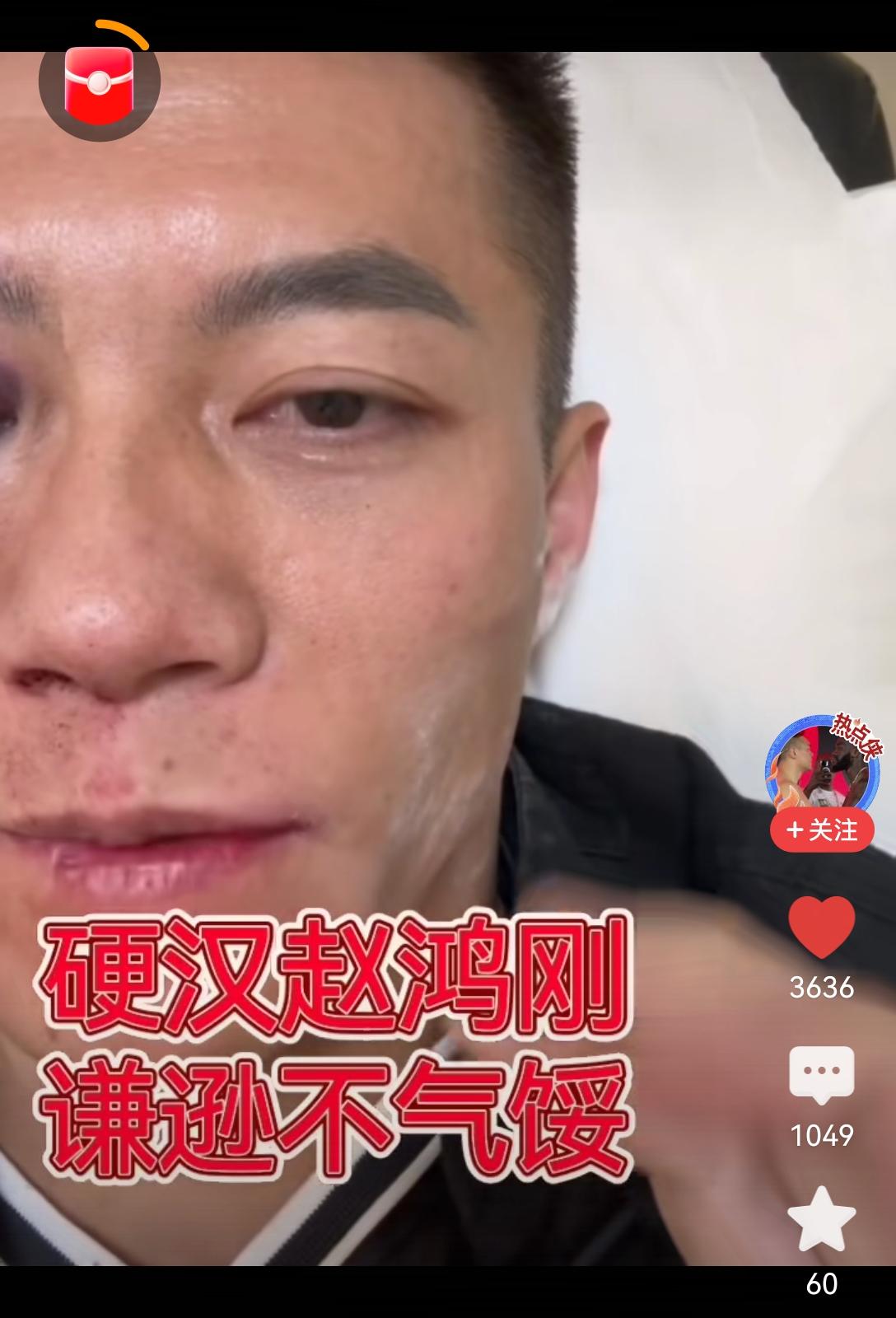 赵洪刚昨天被KO后，应无大碍，很快就“报平安”了[思考]很多人看了比赛过程，觉得