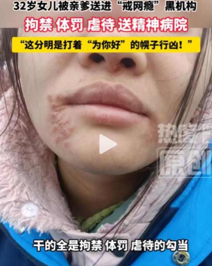"都是为了你好"。湖北一位父亲竟强行把32岁的成年女儿送进一家教育机构进行
