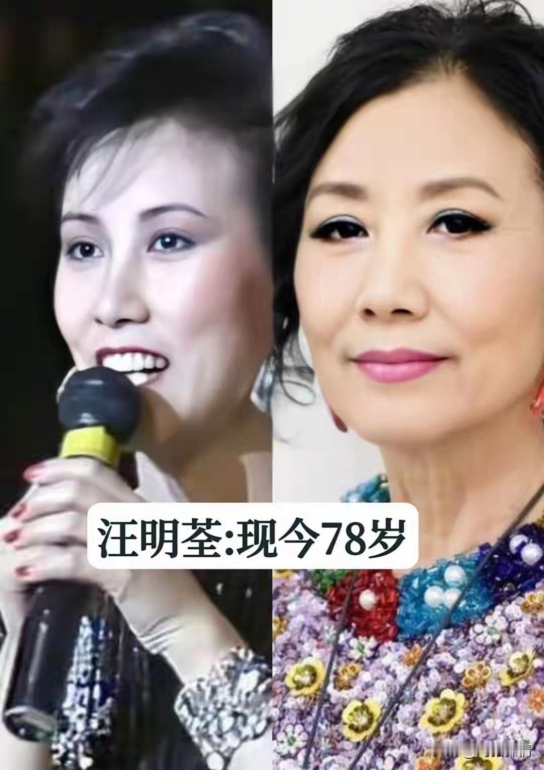 15位春晚表演明星今昔颜值对比