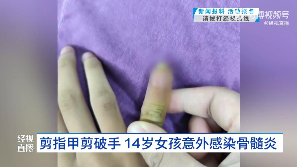 “悲剧还是发生了！”2025年8月，湖北武汉，一女孩在家剪指甲时，不小心剪破了小