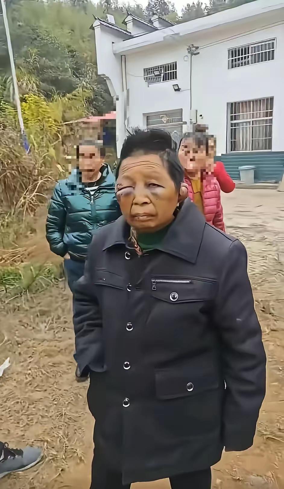 真的是被家暴打的连妈都不认识了。我非常不理解，为什么有些女生，明明智力正常，却